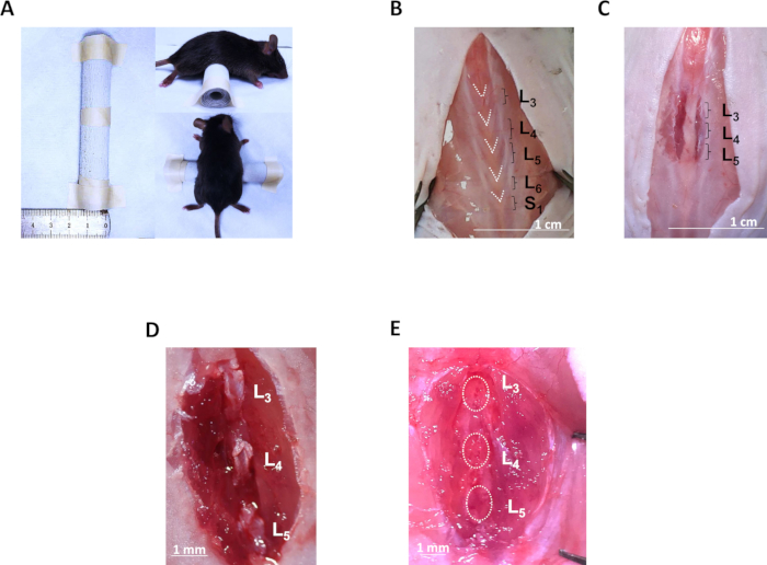 Rodent L3-L5 spinal examination; surgical procedure, anatomical labeling; 5-panel study.
