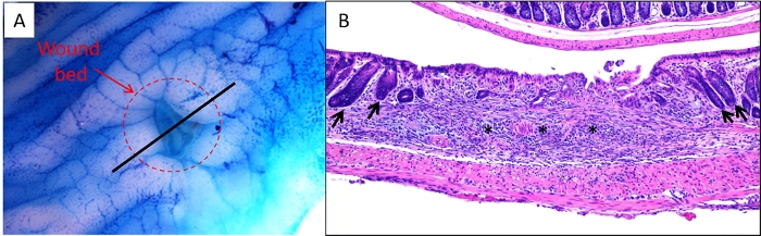 figure-results-1 Wound healing process; histology images, wound bed identification, tissue repair analysis.
