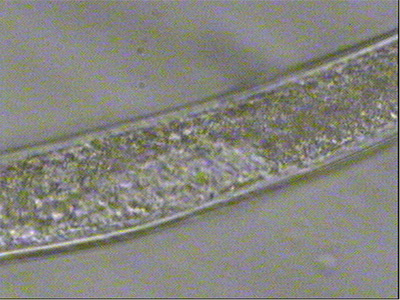 C. elegans under a microscope; biological study, microscopic analysis, laboratory research.