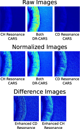 CARS microscopy images showing CH, CD resonances; raw, normalized, and difference; spectral analysis.