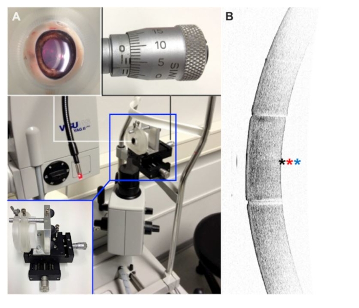figure-results-1 YAG laser setup, microscopy image of optic interface; optical measurement and analysis.