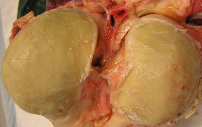 Anatomy dissection, sheep brain showing hemispheres, educational biology study.