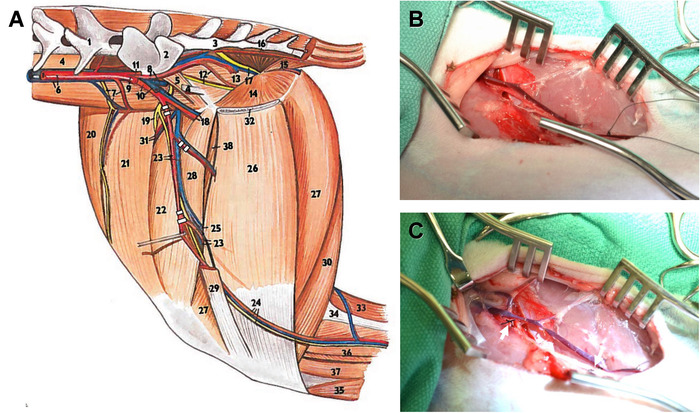 Anatomy diagram and surgical images illustrating shoulder nerve pathways and procedures.