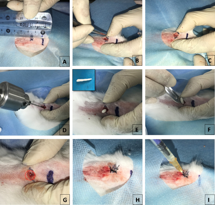Surgical implant procedure diagram with biopsy setup, forceps, measuring tool, and specimen extraction.