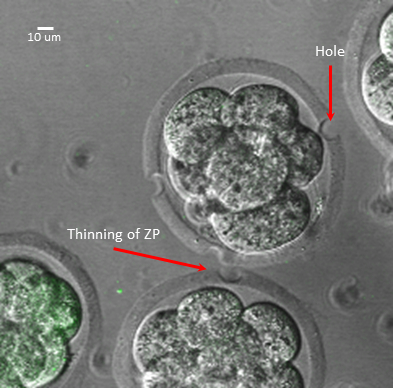 Zygote development; microscope image; thinning of zona pellucida; embryology study; cellular process.