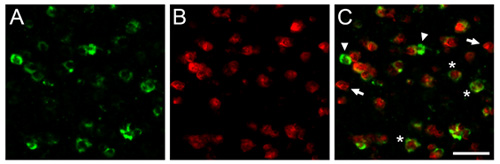 figure-protocol-1 Fluorescence microscopy images showing protein expression patterns; green and red markers in cells.