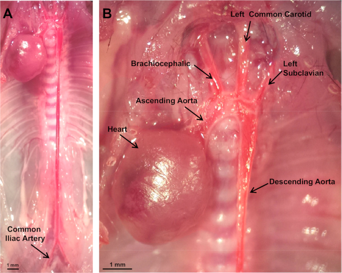 Anatomy diagram of pig arteries labeled; features heart, aorta, carotid, iliac artery.