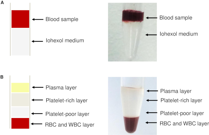 Blood separation diagram showing Iohexol gradient method with blood, plasma, and platelet layers.