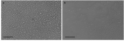 Electron microscopy images showing cell surface morphology comparison.