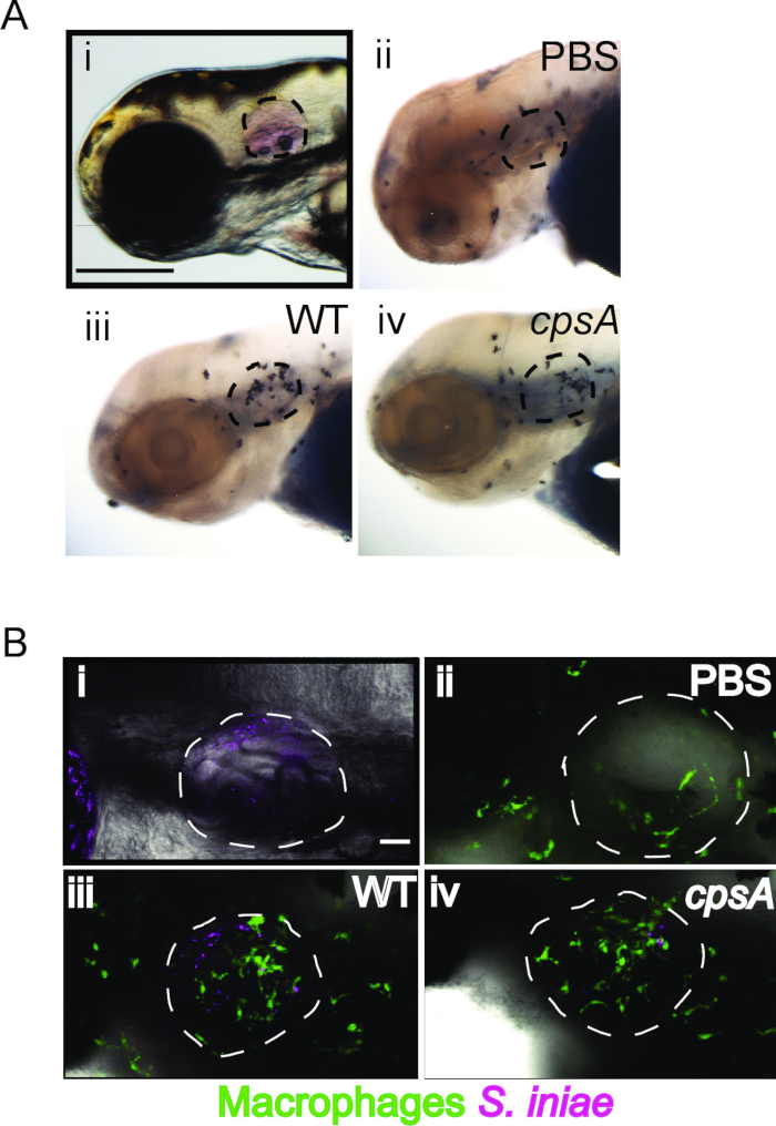 Microscope images of macrophage interactions with S. iniae; immunohistochemistry analysis diagram.