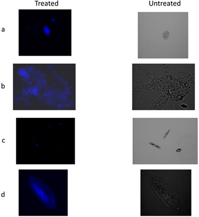 figure-protocol-5 Treated vs. untreated cell microscopy comparison, fluorescence staining, cellular structure analysis.