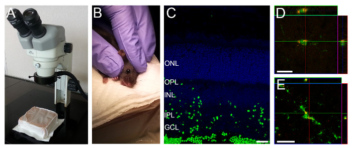 Microscope, animal handling, retinal cell layers, and confocal microscopy in biological research.