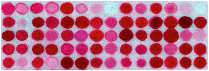 figure-results-1 Dot blot analysis, protein detection, experimental result, microarray visualization.