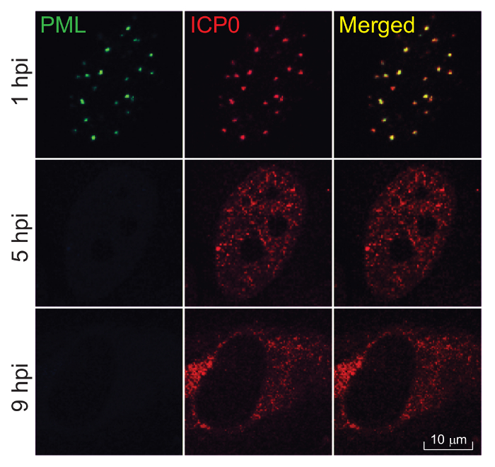 figure-results-1 PML and ICP0 colocalization analysis, time-lapse microscopy diagram, viral protein interaction study.