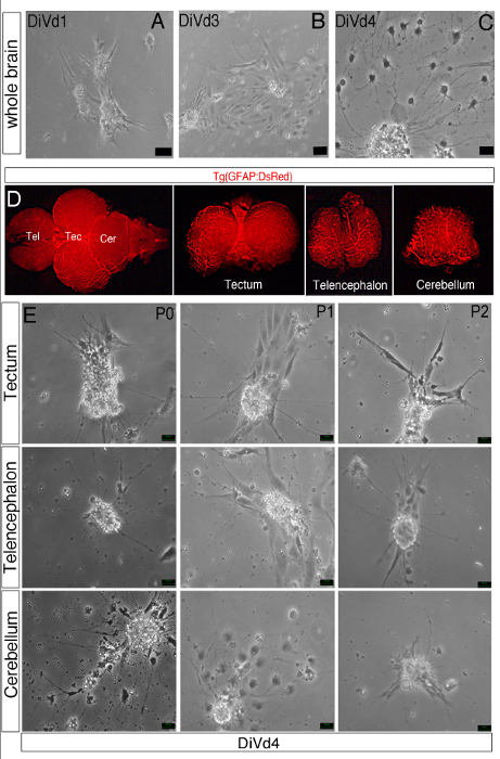 Neural development diagram; brain region microscopy; DsRed fluorescence imaging; cell morphology.