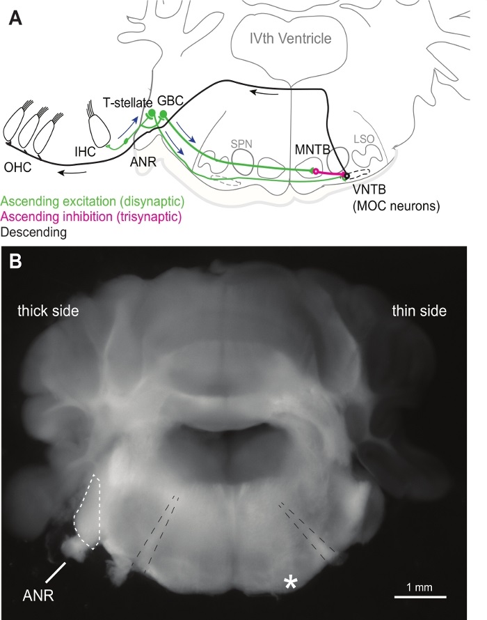 figure-results-1 Neural pathway diagram, auditory nerve response in brain anatomy, disynaptic and trisynaptic excitation.