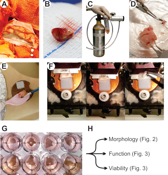 figure-results-1 Surgical grafting process, microscope images of tissue, viability analysis in lab experiment.