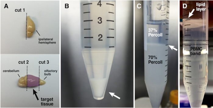 Brain sample dissection and centrifuge tube process; Percoll gradient separation, PBMC isolation.