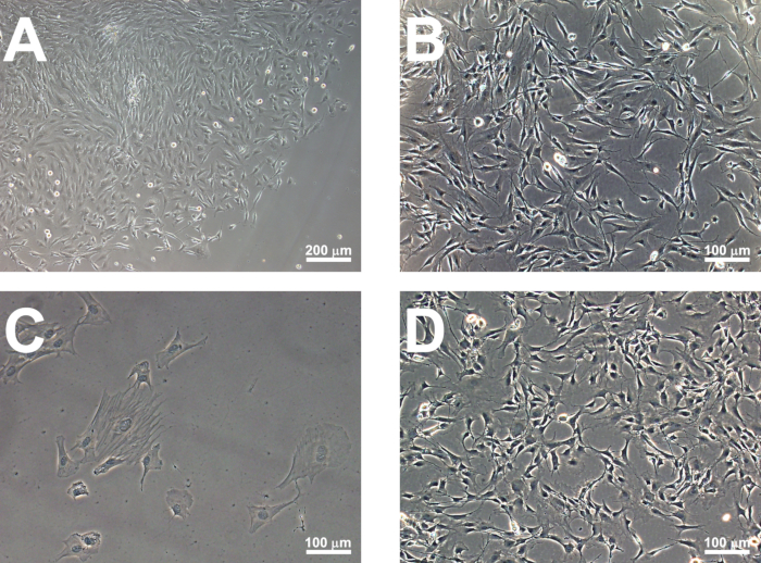 Cell culture images A-D under microscope at varied magnifications, showing cell morphology and density.