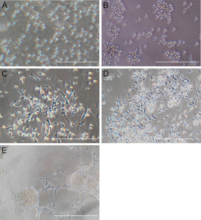 Microscope image of cell cultures at different stages of growth, showing cell density variations.