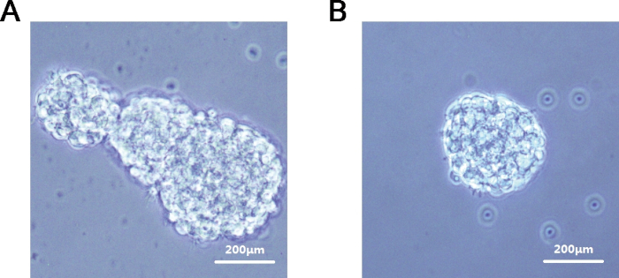 Microscope image of cell clusters; A: elongated, B: spherical; scale 200μm; cell morphology study.
