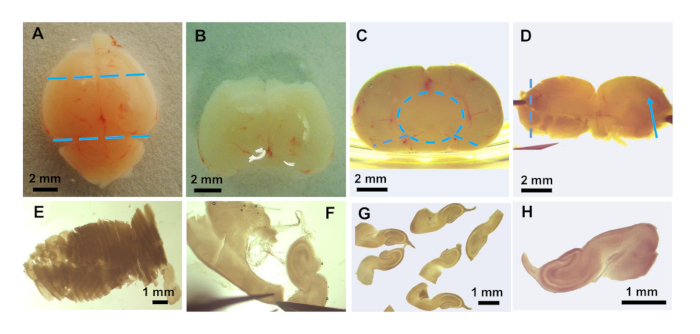 Dissect Embryo A Modified Roller Tube Method for the Long-Term Culture of Rodent Brain ...