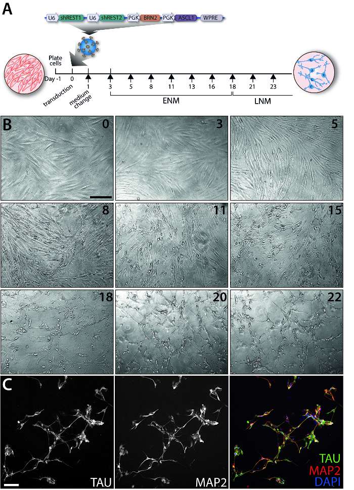 Gene editing process in neuron differentiation; microscopy time-lapse; TAU, MAP2, DAPI staining.