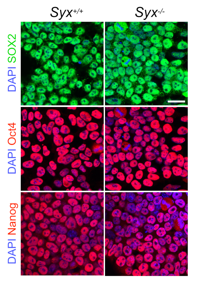 Cell immunofluorescence, Syx+/+ vs. Syx-/-, DAPI stained, SOX2, Oct4, Nanog markers, microscopy.