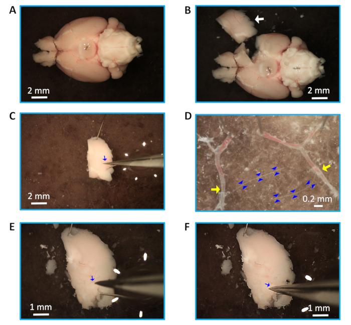 Dissection process in neuroscience; hippocampal slice preparation; microscopic images; detailed view.