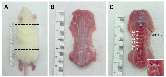 Rat lumbar vertebrae dissection; anatomical study; specimen preparation steps A-C with rulers.