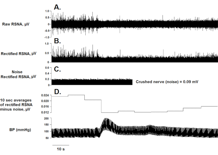 Renal sympathetic nerve activity graph; displays raw, rectified RSNA, noise, blood pressure over time.