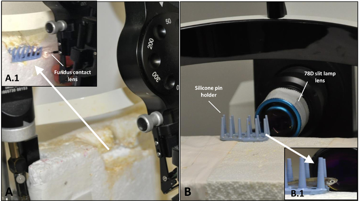 Optical setup with fundus contact lens and 78D slit lamp lens for ocular diagnostics analysis.