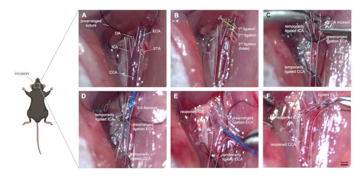 figure-results-1 Surgical procedure on rat for ischemic stroke; prearranged sutures, ligation steps, incision sites.