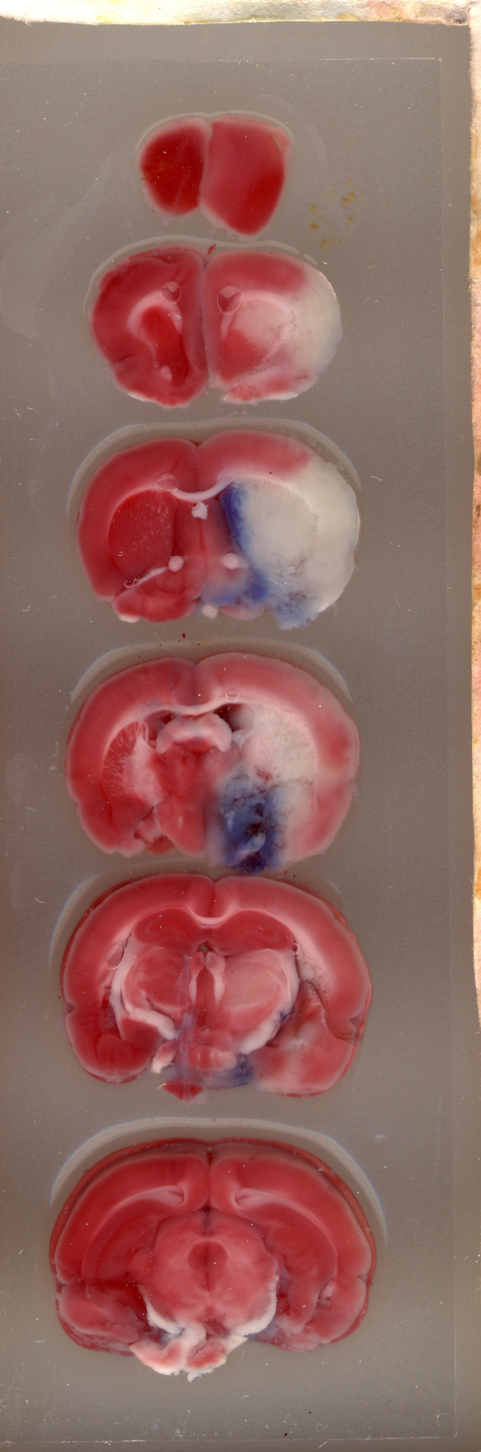 Brain sectioning experiment, coronal slices, histological study, anatomical comparison.