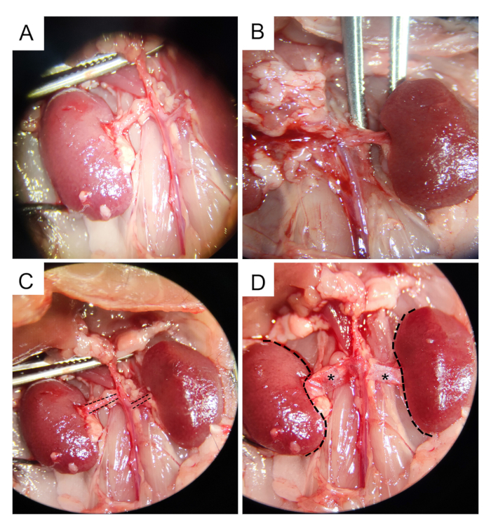 Kidney dissection sequence highlighting renal artery ligation using surgical tools in experimental setup.