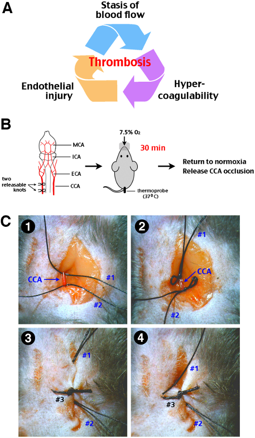 figure-results-1 Thrombosis cycle diagram, hypoxia experiment setup, CCA occlusion surgery sequence images.