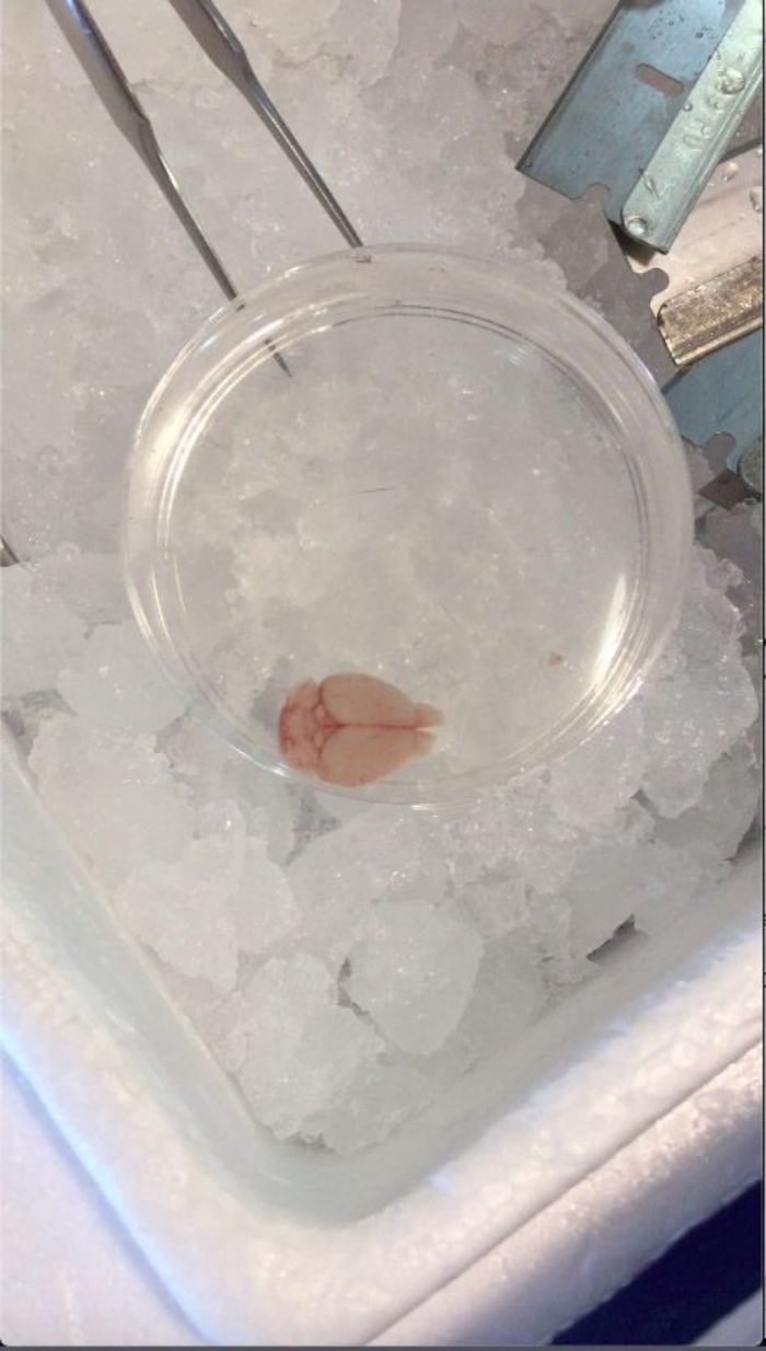 Dissection setup with mouse brain in petri dish on ice for anatomical study and preservation.