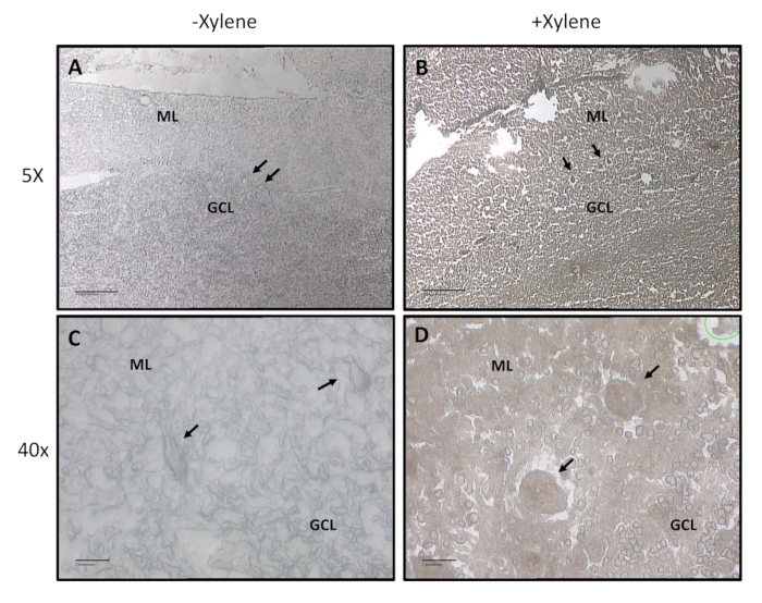 Histology analysis diagram: xylene impact on ML and GCL at 5X, 40X magnification.