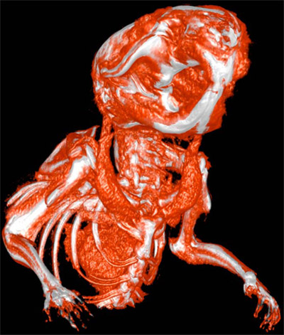 figure-protocol-1 3D CT scan showing skeletal structure, highlighting anatomical abnormalities in a specimen.