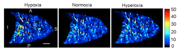 Oxygen level imaging; hypoxia, normoxia, hyperoxia; heatmap diagram with color scale analysis.