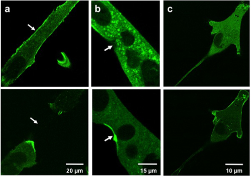 Confocal fluorescence microscopy image showing cell structures at different magnifications (20, 15, 10 μm).