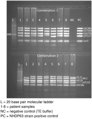 DNA electrophoresis gel diagram; patient samples, molecular markers, controls; genetic analysis.