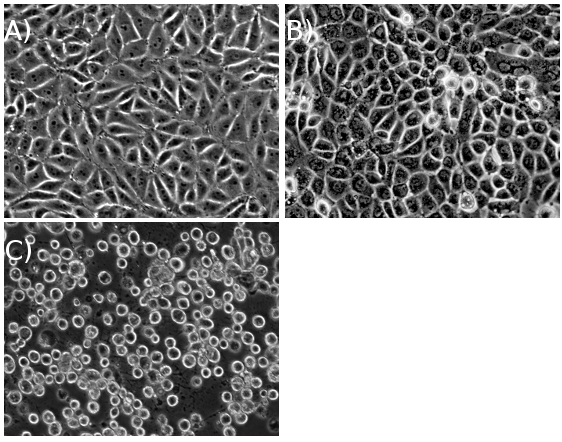figure-protocol-1 Cell morphology comparison; microscope images; A) Fibroblasts, B) Epithelial cells, C) Red blood cells.
