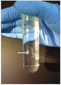 figure-protocol-4 Test tube with DNA precipitation; lab experiment on nucleic acid extraction; gloved hand handling.