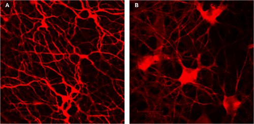 figure-protocol-5 Neural network fluorescence microscopy image showing neuron structures and synapses for analysis.