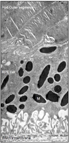 figure-protocol-3 Retinal structure; electron micrograph showing rod outer segments, RPE cells, Bruch's membrane.