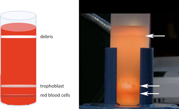 figure-protocol-2 Trophoblast isolation via centrifugation, diagram, and experimental setup, blood component separation.