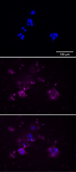figure-protocol-4 Fluorescence microscopy of cell nuclei; blue staining, magnification scale 100 μm; cellular imaging.
