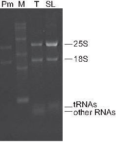 figure-protocol-2 RNA凝胶电泳结果,显示25S、18S rRNA、tRNA及其他RNA条带;分子量标记。