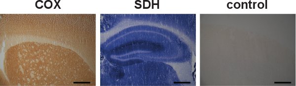 figure-protocol-5 COX, SDH, control stained tissue sections; microscopy image, enzyme activity comparison.